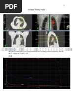 Treatment Planning Project