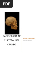 Cabeza - AP y Lateral de Cráneo