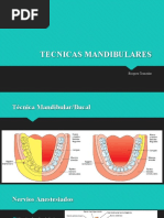 Mandibulares Tecnicas - 014446