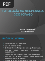 Patología No Neoplásica de Esofago