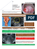 POLIPOSENDOMETRIALES