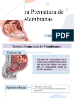 Rotura Prematura de Membranas: Iryumar Utrera