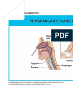 Pengertian Pemasangan NGT