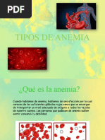 Tipos de Anemia