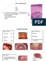 Torus Palatino y Mandibular