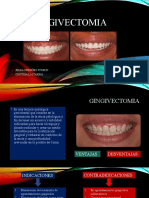 GINGIVECTOMIA