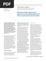 Rapid Maxillary Expansion Before and After Adenotonsillectomy in Children With Obstructive Sleep Apnea - En.es