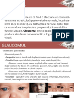 Glaucom Lucrare