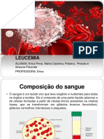 Apresentação Seminario Leucemia