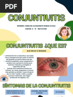 CONJUNTIVITIS