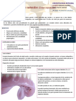 Sobredentaduras en Dientes Naturales