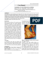 Atypical Presentation of Cystic Fibrosis in An Infant