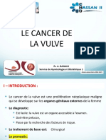 Cancer de La Vulve