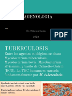 Tuberculosis