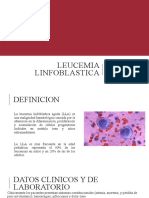 Leucemia Linfoblastica