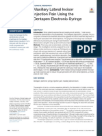 Maxillary Lateral Incisor Injection Pain Using The Dentapen Electronic Syringe