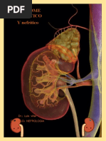 Sindrome Nefrotico