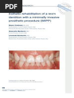 Esthetic Rehabilitation of A Worn Dentition With A Minimally Invasive Prost... : EBSCOhost