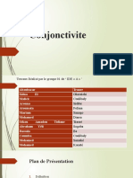 Conjonctivite