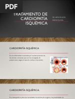 Cardiopatía Isquémica