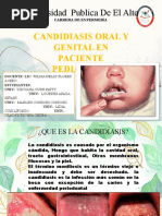 Candidiasis