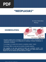 Neoplasia Generalidades