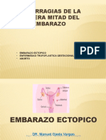 Emb. Ectopico