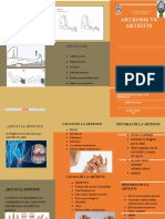 Artritis VS Artrosis