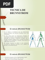 Tecnica de Brunnstrom