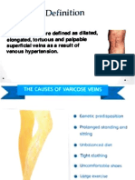 Varicose Veins