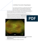 Desprendimiento de Retina Traccional y Regmatógeno Diabético