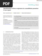 Clinical Case Reports - 2023 - Vyver - Apexification of Dens Evaginatus in A Mandibular Premolar A Case Report