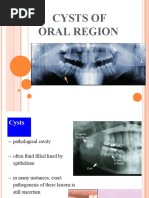 Cysts Dental