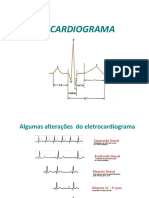 Ecg Grau