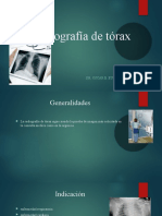 Radiografía de Tórax