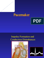 Pacemaker