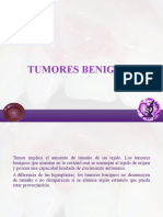 Tumores Benignos-1