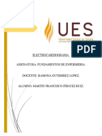 Electrocardiogram A