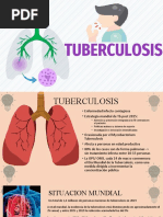 Tuberculosis