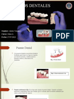 Póntico Dentales