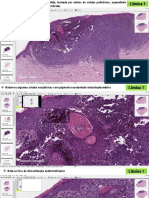 Micro Das Neoplasias 3