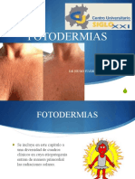 Fotodermias