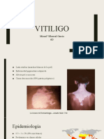 Vitiligo