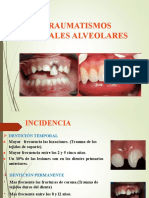 Traumatismos Dentoalveolares