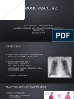 Sindrome Vascular