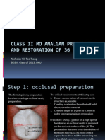 IPR - Class II MO Preparation Restoration of 36