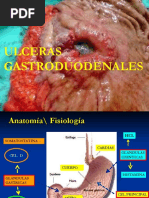 Ulcera Gastrica 2023