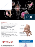 Artritis Reumatoide