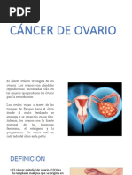 Cancer de Ovario