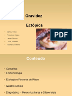 Gravidez Ectópica: Carlos, Tânia Francisco, Higino Langa, Gomes Lucas, Gilberto Machava, Sidónio